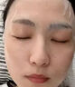 医用冷敷贴面膜型械字号透明质酸钠修复贴敷料医美术后消炎去红美白补水晒后修复收缩毛孔祛痘控油淡化痘印 实拍图