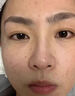 医用冷敷贴面膜型械字号透明质酸钠修复贴敷料医美术后消炎去红美白补水晒后修复收缩毛孔祛痘控油淡化痘印 实拍图