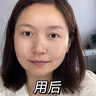 透真六胜肽抗皱精华液次抛 提拉紧致抗衰老淡化细纹法令纹面部精华女 实拍图