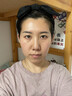 MN泪沟填充面部胶原蛋白丰盈额头法太阳穴令纹脸颊眼窝凹除陷去神器 1盒【医美原料】初步提亮眼周 实拍图