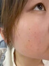本安制药湿疹膏肛门肛周阴囊皮肤瘙痒皮炎湿疹皮癣真菌止痒专用汗疱疹1盒 实拍图