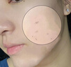 BEAUTY NOTES去角质面部啫喱控油保湿洗面奶男女士清洁毛孔黑头闭口温和不刺激 实拍图