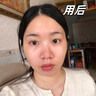 透真377美白精华液次抛淡化黑色素祛斑去黄提亮改善暗沉肤色烟酰胺女 实拍图