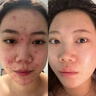 宝拉珍选2%水杨酸精华液进口版2水杨酸精华露30ml祛痘控油去粉刺闭口 30ml*1瓶【2%水杨酸】 实拍图