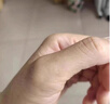 DRVIALY祛疣灵扁平疣丝状疣面部非药膏专用脖子颈瘊子去疣克疣跖膏疣神器 5盒装【疣体灭绝-德国特效果】 实拍图