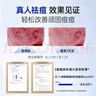 仁和匠心 祛痘点涂精华液 减缓粉刺男女青春痘熬夜姨妈痘舒缓保湿控油10ml 实拍图