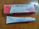 999三九皮炎平复方醋酸地塞米松乳膏 20g:15mg 20g/支 神经性皮炎 接触性皮炎 脂溢性皮炎 慢性湿疹 皮肤瘙痒 实拍图