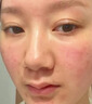 Newliann医用重组胶原蛋白修复敷料乳液人表皮生长因子凝胶皮肤屏障面霜 实拍图