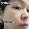 ORGINESE积雪草补水喷雾爽肤水小分子保湿水舒缓化妆水湿敷护肤品精华男女 实拍图