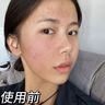 透真377美白精华液次抛淡化黑色素祛斑去黄提亮改善暗沉肤色烟酰胺女 实拍图