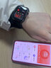 逸博士【专业级精准】高端智能健康监测手表 Watch精准血压监测气泵式睡眠心率心电血糖手环 玉鎏金【礼盒装】 【2026新款，旗舰正品，高端血压手表】 实拍图