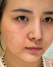 久卜制药烟酰胺凝胶补水保湿精华淡化黑色素色斑霜男女士专用1盒装 实拍图
