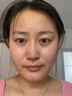 OHBT黄芪面膜10片抗皱紧致抗衰老补水熬夜焕白淡斑女男士金榜第1名 实拍图