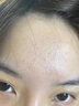 医用精华液械字号收缩毛孔粗大修复细致去黑头粉刺闭口男士女士祛痘印黑色素沉淀控油淡化痘印痘坑透明质酸钠 实拍图