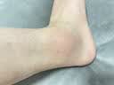 李时珍苗疆透骨膏风湿关节痛膏止风湿痛透骨膏颈椎腰椎膝盖关节舒缓跌打 10瓶【三疗程】大面积使用+贈棉签 实拍图