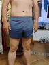 阴囊潮湿专用药男私处蛋蛋痒用什么药真菌感染皮肤用药男人下体私处瘙痒睾丸痒疼药止痒药膏硝酸咪康唑乳膏 2盒【 瘙痒 红肿 刺痛】一抹止痒 杀灭真菌 实拍图