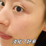 透真美白淡斑精华液 377抗皱紧致美白提亮 577祛斑紧致去黄vc精华 实拍图