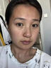 脸部凹陷填充液胶原蛋白太阳穴泪沟眼窝凹陷填充神器面部修复精华 单瓶装【修复脸凹陷】 30ml 实拍图