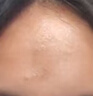 YYTISS祛疤膏疤痕专用修复除疤膏医用硅酮疤痕凝胶儿童增生凸起去除疙瘩 实拍图
