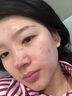 ORGINESE祛痘膏平痘印痘坑复修改善粉刺闭口痘痘和痘印精华男女礼物 实拍图