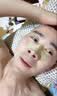 御医匠鼻炎鼻贴过敏性鼻炎鼻窦炎贴鼻塞鼻痒治根穴位贴儿童成人专用膏药 【单盒装】 实拍图
