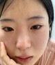 本田制药烟酰胺凝胶医用美白祛斑淡化黑色素色斑烟酰胺男女专用3盒 实拍图