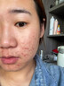 BEAUTY NOTES天然芦荟胶补水保湿晒后2盒装 实拍图