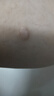 YYTISS祛疤膏疤痕专用修复除疤膏医用硅酮疤痕凝胶儿童增生凸起去除疙瘩 实拍图