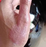 同仁堂湿疹止痒软膏 阴囊潮湿皮炎皮癣肛周肛门阴部私处皮肤瘙痒成人 实拍图