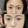 透真377美白精华液次抛淡化黑色素祛斑去黄提亮改善暗沉肤色烟酰胺女 实拍图