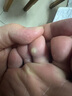 本安制药日本鸡眼贴鸡眼膏去肉刺刺猴无刺痛脱落脚根手部跖疣专用12贴/盒 实拍图
