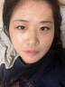 白云山祛痘膏去痘痘和痘印青春痘学生祛痘印粉刺淡化痘印痘坑修护18g 实拍图