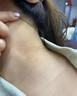 薪琦茗脖子黑色素去除脖子黑黑的适用可搭药膏黑棘皮黑色素沉淀200ml 实拍图
