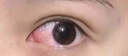 霍悉医生叶黄素滴眼液非眼药水缓解眼疲劳熬夜玩手机视力模糊眼干眼涩发痒 实拍图