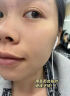 透真金盏花爽肤补水提亮护肤保湿敷极光水控油收缩毛孔舒缓妆前男女士 实拍图