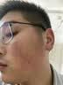 鸡皮肤疙瘩毛囊角化症专用非药儿童脸部身体毛周角化疙瘩颗粒去除 维E特效霜儿童鸡皮肤疙瘩闭口粉刺克星 实拍图