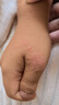 首儿儿童肤乐霜婴幼儿宝宝舒缓干湿痒口水膏护臀膏全身可用护肤霜5g 实拍图