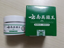 悠颐宝云南真菌王全身止痒脚后跟开裂专用膏官方手足脱皮抑菌皮肤疹乳膏 实拍图