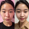 WXYZ小分子胶原蛋白肽美容养颜内服抗氧糖可搭抗衰老紧致皮肤女美白丸 【1瓶体验装】专注女性肌肤老化 实拍图