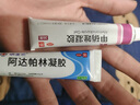 丽芙甲硝唑凝胶20g+阿达帕林16g甲硝锉凝胶祛痘印修复淡化痘印痘坑修复药膏 实拍图