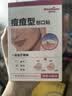 Newliann医用祛痘贴消炎吸脓隐形祛痘印修复淡化痘印痘坑痘痘贴人工皮正品 实拍图