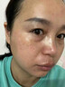 IOEO5%氨甲环酸精华液传明酸湿敷液黄褐斑医美术后外用美容院湿敷面膜 5%浓度氨甲I环酸+【湿敷棉】 实拍图