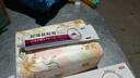 久卜制药祛痘膏青春痘祛痘淡化痘印痘坑消炎痤疮粉刺专用学生青少年 3盒 实拍图