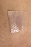 美皮护Mepiform疤痕贴剖腹产甲状术后淡疤抚痕儿童疤痕修护疤痕贴 贴393130 1片2.5*10cm+ 膏7g1支 实拍图