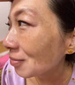 南京同仁堂祛斑霜美白淡化黑色素老年黄褐雀晒斑烟酰胺去黄提亮肤色男女面霜 2瓶优惠装【立省10】 实拍图