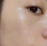 医用精华液械字号收缩毛孔粗大修复细致去黑头粉刺闭口男士女士祛痘印黑色素沉淀控油淡化痘印痘坑透明质酸钠 实拍图