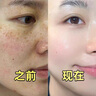 透真美白淡斑精华液 377抗皱紧致美白提亮 577祛斑紧致去黄vc精华 实拍图