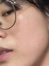 医用冷敷贴面膜型械字号透明质酸钠修复贴敷料医美术后消炎去红美白补水晒后修复收缩毛孔祛痘控油淡化痘印 实拍图