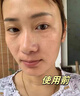 OHBT黄芪面膜10片抗皱紧致抗衰老补水熬夜焕白淡斑女男士金榜第1名 实拍图
