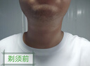 飞利浦（PHILIPS）电动剃须刀7系变形金刚威震天联名 SkinIQ肌能感应微提切科技刮胡刀 生日礼物送老公 国家补贴 实拍图